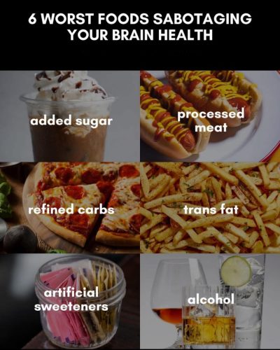 Charts - Brain health
